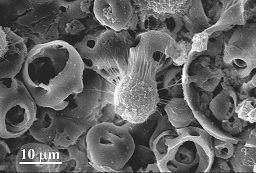 Влияние наночастиц оксигидроксида алюминия на структуру и свойства кальцийфосфатных покрытий